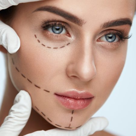Jawline Filler